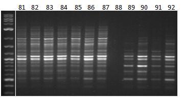 Εικόνα 38ε: Ηλεκτροφόρηση των προϊόντων της PCR 12 διαφορετικών ατόμων (No.