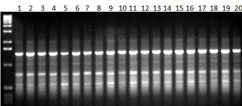 Εικόνα 39α: Ηλεκτροφόρηση των προϊόντων της PCR 20 διαφορετικών ατόμων (No. 1-20) C. sativus L.