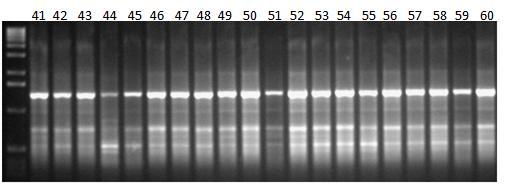 Εικόνα 39β: Ηλεκτροφόρηση των προϊόντων της PCR 20 διαφορετικών ατόμων (No. 21-40) C. sativus L.