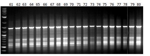 Εικόνα 39δ: Ηλεκτροφόρηση των προϊόντων της PCR 20 διαφορετικών ατόμων (No.