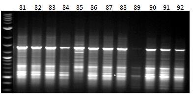 Εικόνα 39ε: Ηλεκτροφόρηση των προϊόντων της PCR 12 διαφορετικών ατόμων (No.