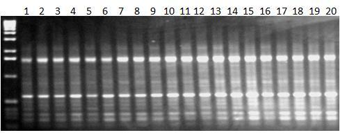 Εικόνα 40α: Ηλεκτροφόρηση των προϊόντων της PCR 20 διαφορετικών ατόμων (No.