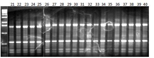 Εικόνα 40β: Ηλεκτροφόρηση των προϊόντων της PCR 20 διαφορετικών ατόμων (No.