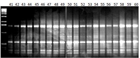 Εικόνα 40γ: Ηλεκτροφόρηση των προϊόντων της PCR 20 διαφορετικών ατόμων (No.