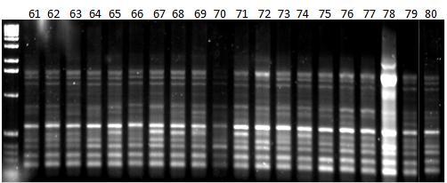 Εικόνα 40δ: Ηλεκτροφόρηση των προϊόντων της PCR 20 διαφορετικών ατόμων (No.