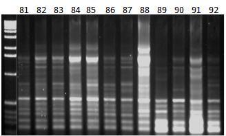 Εικόνα 40ε: Ηλεκτροφόρηση των προϊόντων της PCR 12 διαφορετικών ατόμων (No.