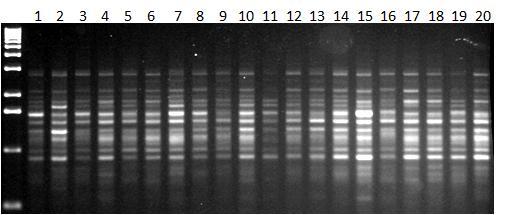 Εικόνα 41α: Ηλεκτροφόρηση των προϊόντων της PCR 20 διαφορετικών ατόμων (No.