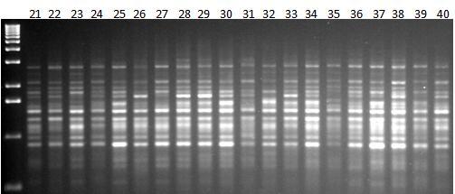 Εικόνα 41β: Ηλεκτροφόρηση των προϊόντων της PCR 20 διαφορετικών ατόμων (No.