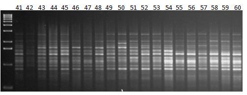 Εικόνα 41γ: Ηλεκτροφόρηση των προϊόντων της PCR 20 διαφορετικών ατόμων (No.