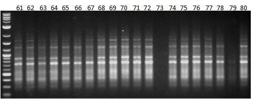 Εικόνα 41δ: Ηλεκτροφόρηση των προϊόντων της PCR 20 διαφορετικών ατόμων (No.