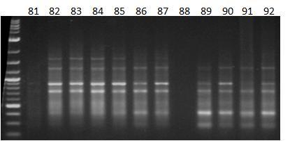 Εικόνα 41ε: Ηλεκτροφόρηση των προϊόντων της PCR 12 διαφορετικών ατόμων (No.
