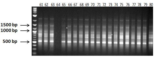 Εικόνα 31δ: Ηλεκτροφόρηση των προϊόντων της PCR 20 διαφορετικών ατόμων C. sativus L. (No.