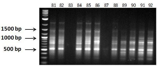 Εικόνα 31ε: Ηλεκτροφόρηση των προϊόντων της PCR 20 διαφορετικών ατόμων C. sativus L. (No.