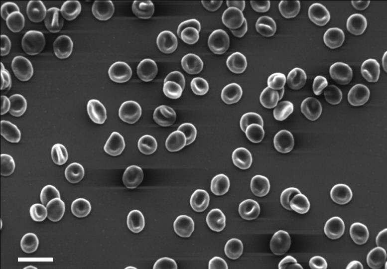 Εικόνα 15: Ενδεικτική φωτομικρογραφία ΗΜ Σάρωσης ερυθροκυττάρων υγιούς ατόμου.