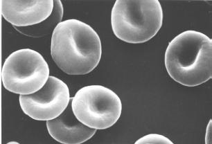 1.ΕΙΣΑΓΩΓΗ 1.1 Το ερυθροκύτταρο Σε όλα τα σπονδυλωτά το αίμα αποτελείται από έμμορφα στοιχεία στα οποία περιλαμβάνονται τα κύτταρα και το άμορφο συστατικό που ονομάζεται πλάσμα.