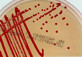 SERRATIA