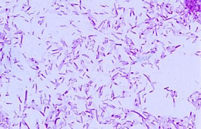 E. COLI
