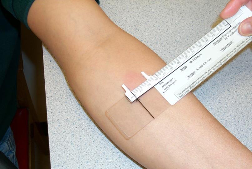 Τι δείχνει το test?