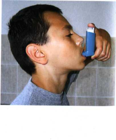 Etapele folosirii flaconului inhalator 1. Scoateţi capacul şi agitaţi bine inhalatorul 2. Ţineţi inhalatorul între degetul mare şi arătător 3.