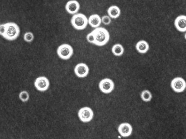 AMERIKA ERDIKO GAIXOTASUN INFEKZIOSO INPORTATUAK KRIPTOKOKOSIA Cryptococcus neoformans onddoa