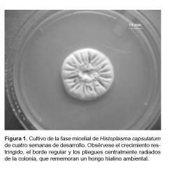 HISTOPLASMOSIA GIB+ PAZIENTEETAN PATOGENIA Histoplasma capsulatum