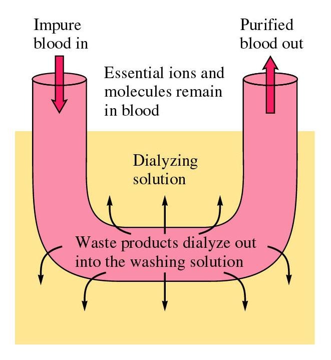 Ulaz zaprljane krvi Izlaz prečišćene krvi Vešta tački bubreg Esencijalni joni i