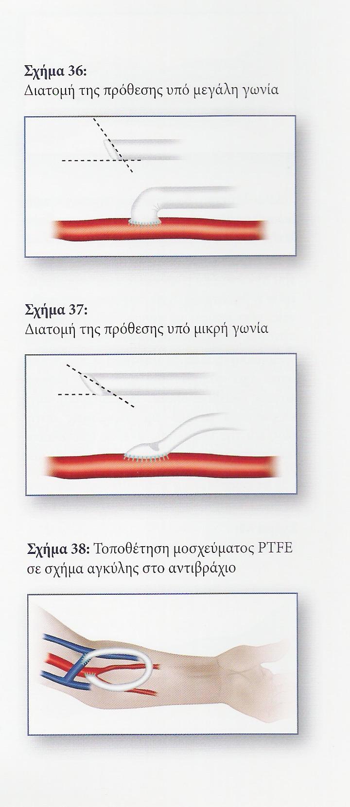 Βραχιοκεφαλική