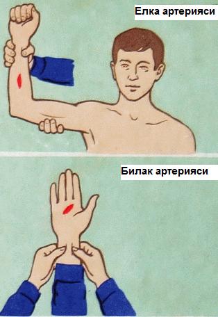 24-расм. Томир бўйлаб босиб туриш. 6. Жгут боғлаш. Бу айниқса, артериал қон кетишни тўхтатишда асосий усул ҳисобланади.
