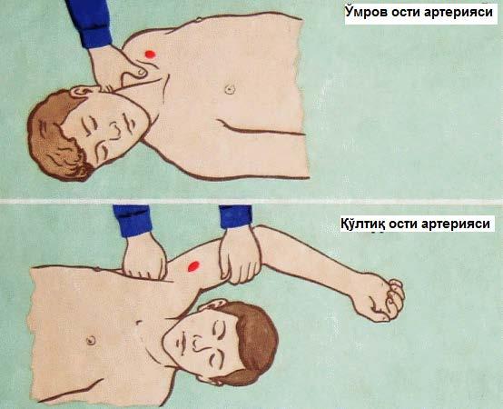 Жгут боғлашдан олдин терини қисиб қўймаслик учун оёқ ёки қўлга сочиқ, бинт ўралади. Жгут чўзилиб, оёқ ёки қўл атрофида айлантирилади.