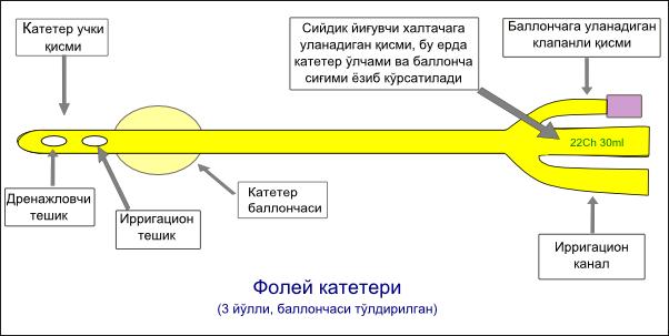 32-расм. Фолей катетери (икки йўлли).