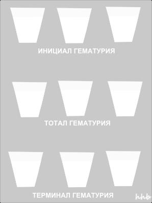 текширув билан аниқлаш мумкин бўлади. Гломеруляр ва ногломеруляр гематурия турларини ҳам фарқлаш лозим. Бу гематурия сабабини аниқлашни осонлаштирувчи тасниф ҳисобланади.