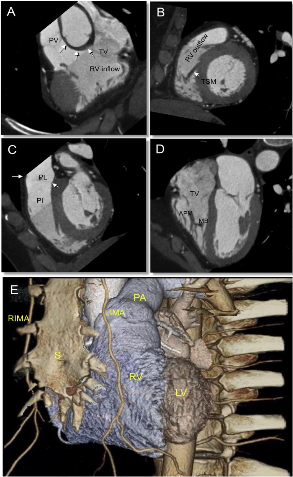 Μέγεθος ΔΚ CT E. Surkova et al.