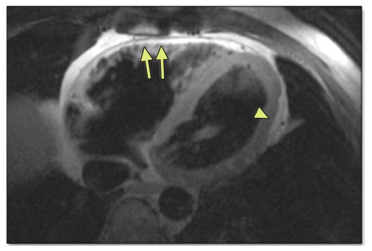 Surkova et al.