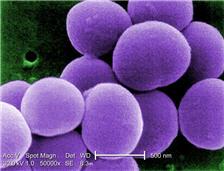 Χρυσίζων σταφυλόκοκκος (Staphylococcus aureus) (4-7) Ο χρυσίζων σταφυλόκοκκος είναι ένας Gram θετικός, ακίνητος, μη σπορογόνος κόκκος, με διάμετρο περίπου 1μm.