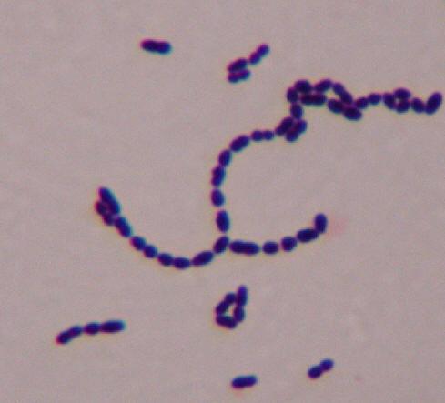 Εικόνα 8. Streptococcus spp όπως όπως φαίνεται χαρακτηριστικά στο μικροσκόπιο μετά από Gram χρώση.