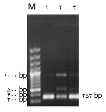 coli XL1-Blue تصوير شماره 1 : ژن توالي اتصال در ژنوم باكتري (attb) تكثير و جدا شده از وكتور pdrbb2 با استفاده از PCR محصول PCR بر روي ژل آگارز %1 جهت خالص سازي از ژل بارگذاري شد. M ماركر 100 جفت بازي.
