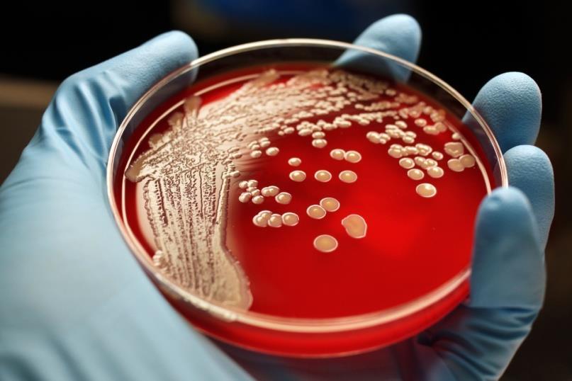 Η απειλή του MRSA Ένα παγκόσμιο πρόβλημα που απασχολεί και την