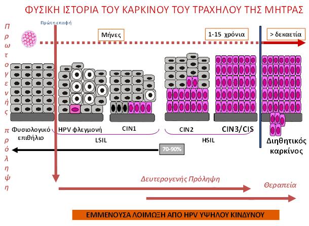 τάξης 60-74%. Μικρή, αλλά όχι μηδενική, είναι η πιθανότητα ακόμα και οι σοβαρού βαθμού δυσπλασίες να παραμείνουν σταθερές, χωρίς να μετατραπούν σε καρκινικές βλάβες [Kumar V et al, 2001].