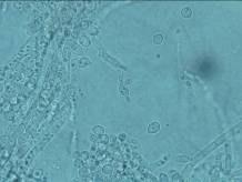 ( PCR EF16 EF15 PCR (bp ) [].. Mega 3.