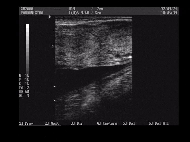 Ultrazvučna pretraga: Ocjena faze
