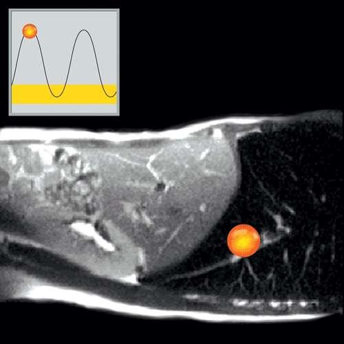 Respiratory Tracking Η δέζκε αθηηλνβνιίαο ελεξγνπνηείηαη όζν ν όγθνο - ζηόρνο είλαη