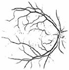 Goldbaum, Detection of blood vessels in retinal images using twodimensional matched filters, IEEE Trans on Med. Image., vol. 8, pp. 63 69, Sept.1989.