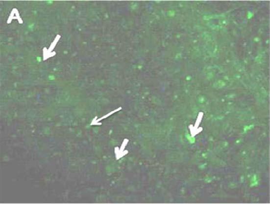 571 هما محسني كوچصفهاني و همكاران اوليه كريستالين alpha A+ alpha B crystalline antibody و (ab28163) رنگآميزي شدند.