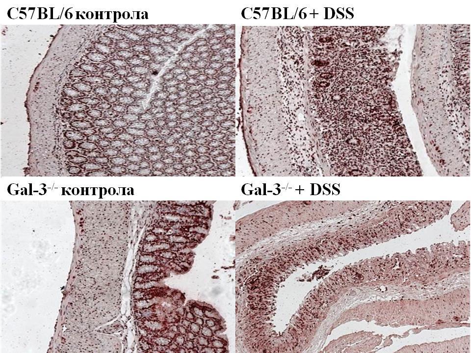 РЕЗУЛТАТИ 4.2.4. Делеција гена за Gal-3 смањује експресију NALP-a и IL-1β у ткиву колона У ткиву колона одређивана је експресија NALP-a и IL-1β имунохистохемијском и PCR методом.