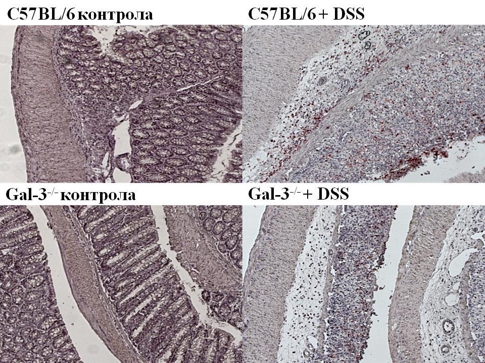 РЕЗУЛТАТИ Слика 14б. Експресија IL-1β у ткиву колона C57BL/6 и Gal-3 -/- мишева третираних DSS-ом. Експресија гена за NLRP3 и IL-1-β је одређивана у ткиву колона методом PCR.