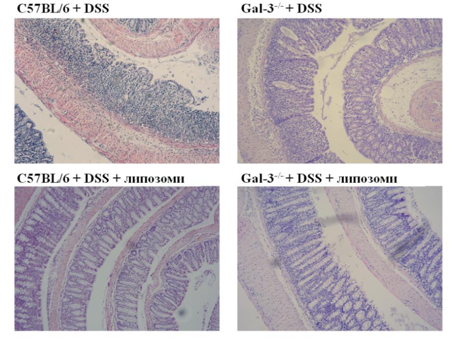 Gal-3 -/- мишева третираних DSS-ом. Није било значајне разлике у хистолошком скору између група које се примиле липозоме.