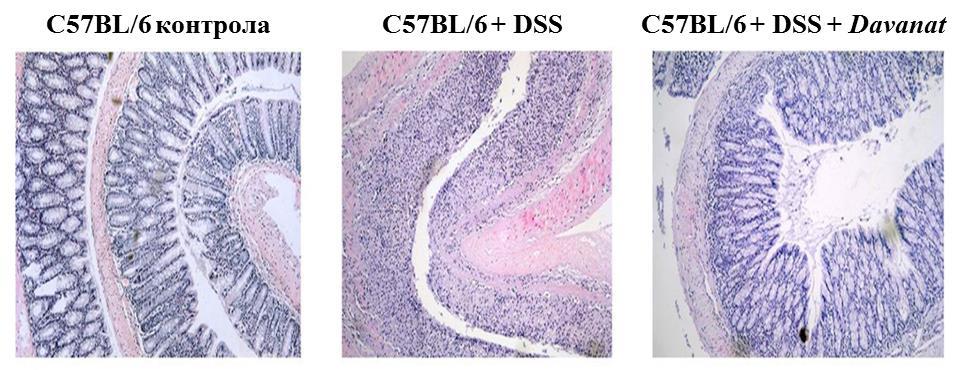 РЕЗУЛТАТИ Слика 22. Репрезентативни препарати колона C57BL/6 мишева након примене Davanat. Стандарно патохистолошко бојење (увећање x10