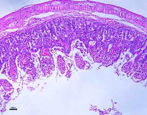 Aspect histologic de gastroenterită.