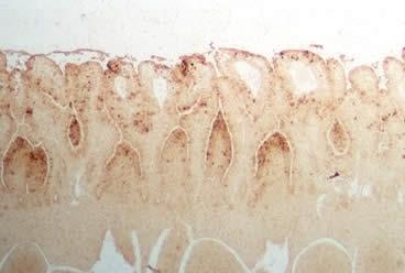 gastrointestinale şi - procese