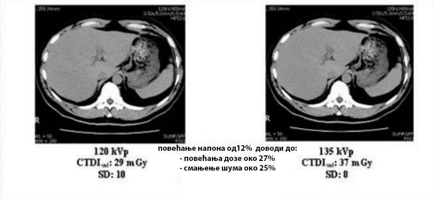 Треба нагласити да повећање напона цеви не доводи до смањења дозе код СТ прегледа као што је то случај код класичне радиографије.